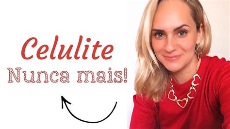 10 dicas para diminuir a celulite